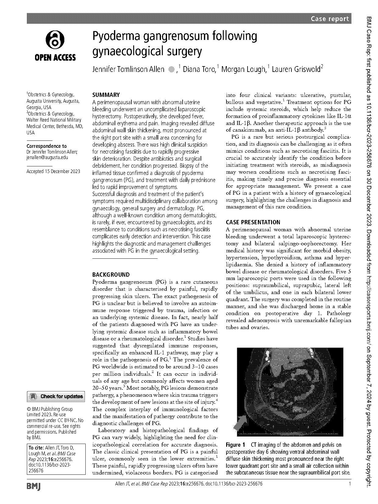 which statement regarding the pathogenesis of necrotizing fasciitis is incorrect